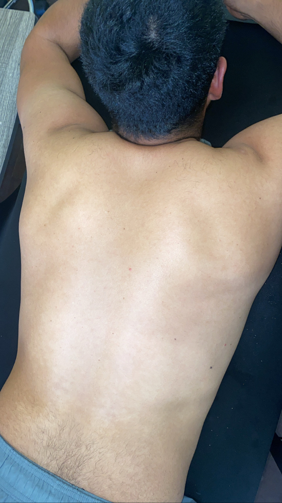 Back Facial