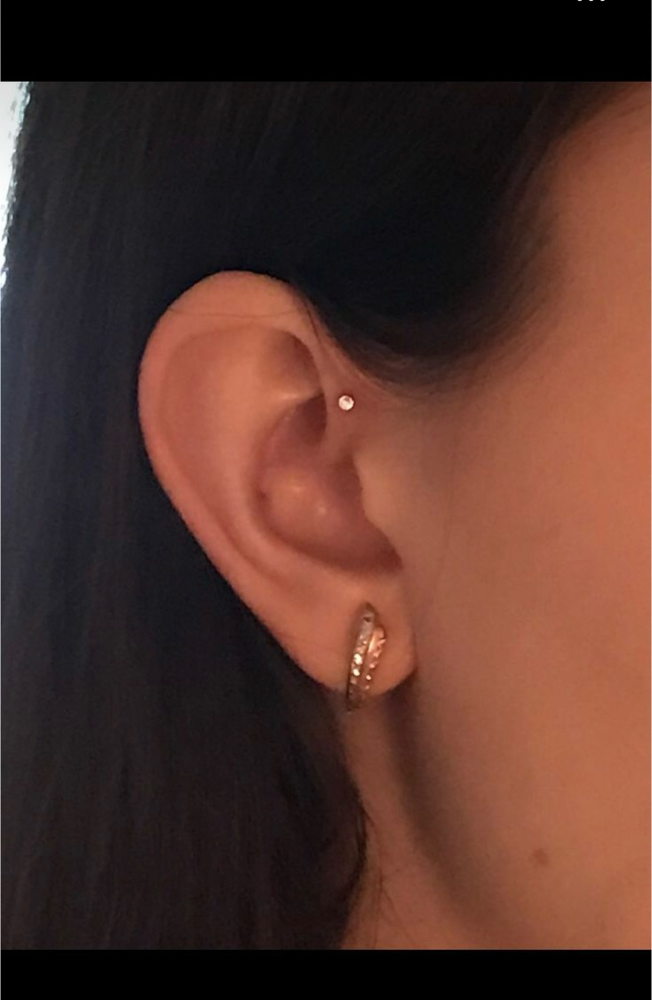 Forward Helix