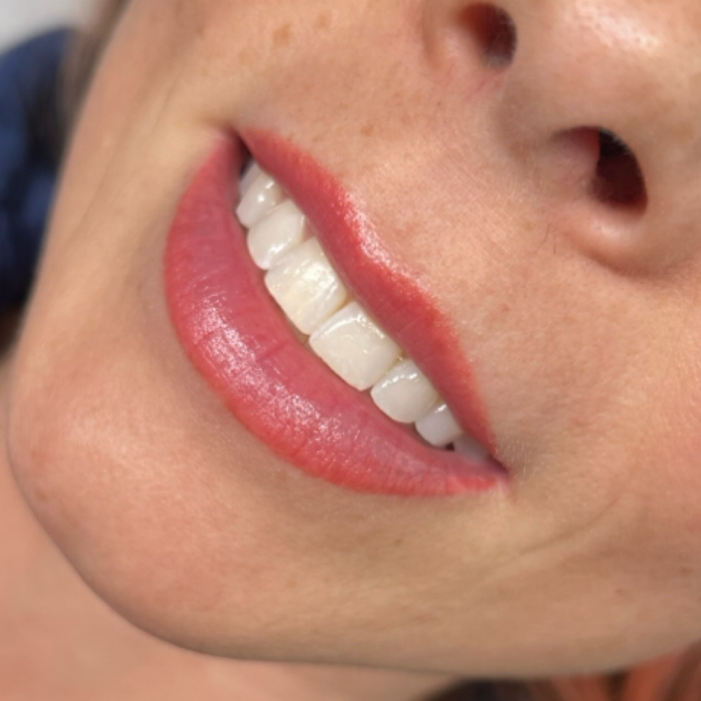 LIP BLUSH Tattoo 0-2 Month Touch Up at Permanent MakeUp Studio by Laura Valtere in Key west, FL