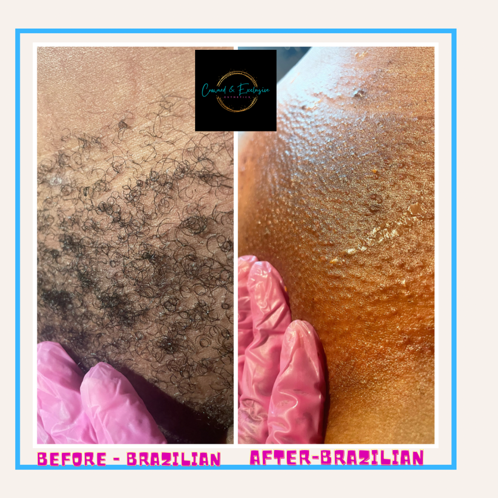 Brazilian Plus Vajacial at Crowned Exclusive Esthetics in Kansas City, MO