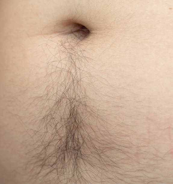 Stomach Strip (Happy Trail) at LJ’s Aesthetics in Paris, ME