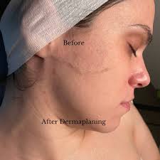 Express Dermaplane Facial