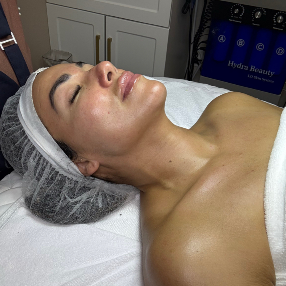 Collagen Glow Facial (Dermapen) at Cuerpo Latina Esthetic in Lakeland, FL