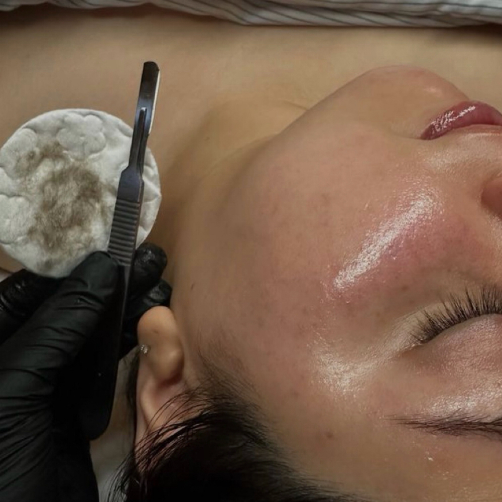 Dermaplane Facial at Caylie Brooke Beauty in Kingston, TN