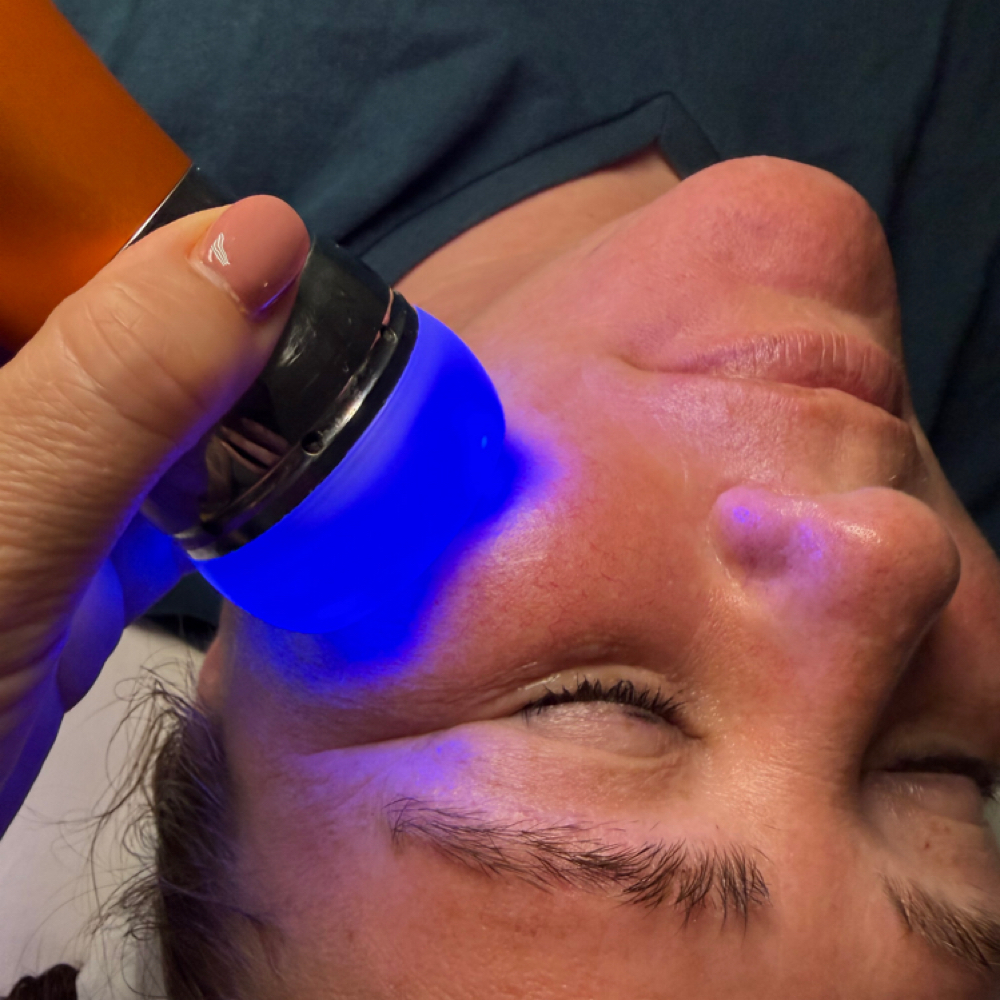 Coco Treatment at Stacey Carta Skin Care in Concord, CA