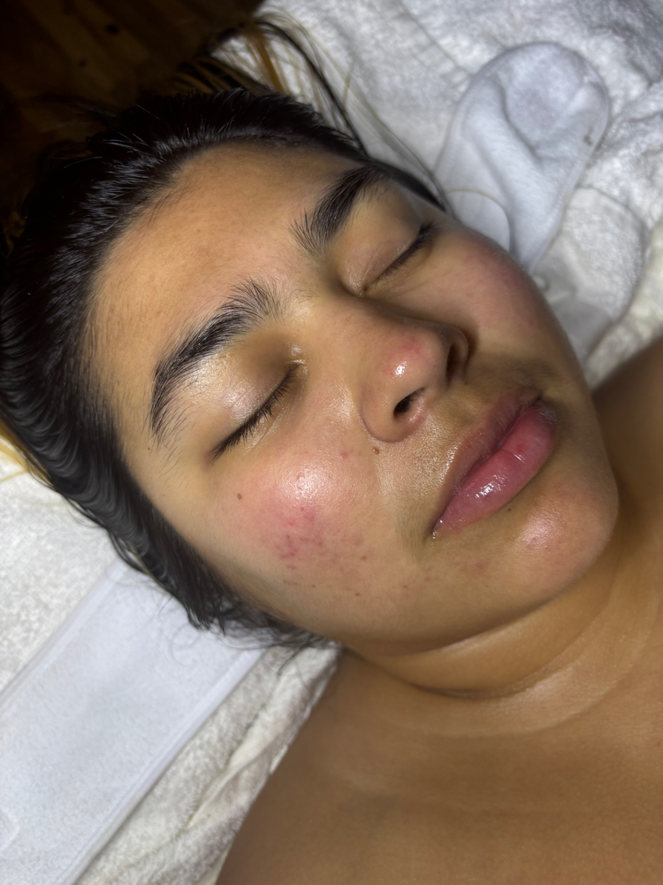 European Facial