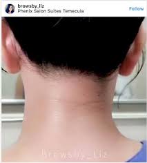 Neck