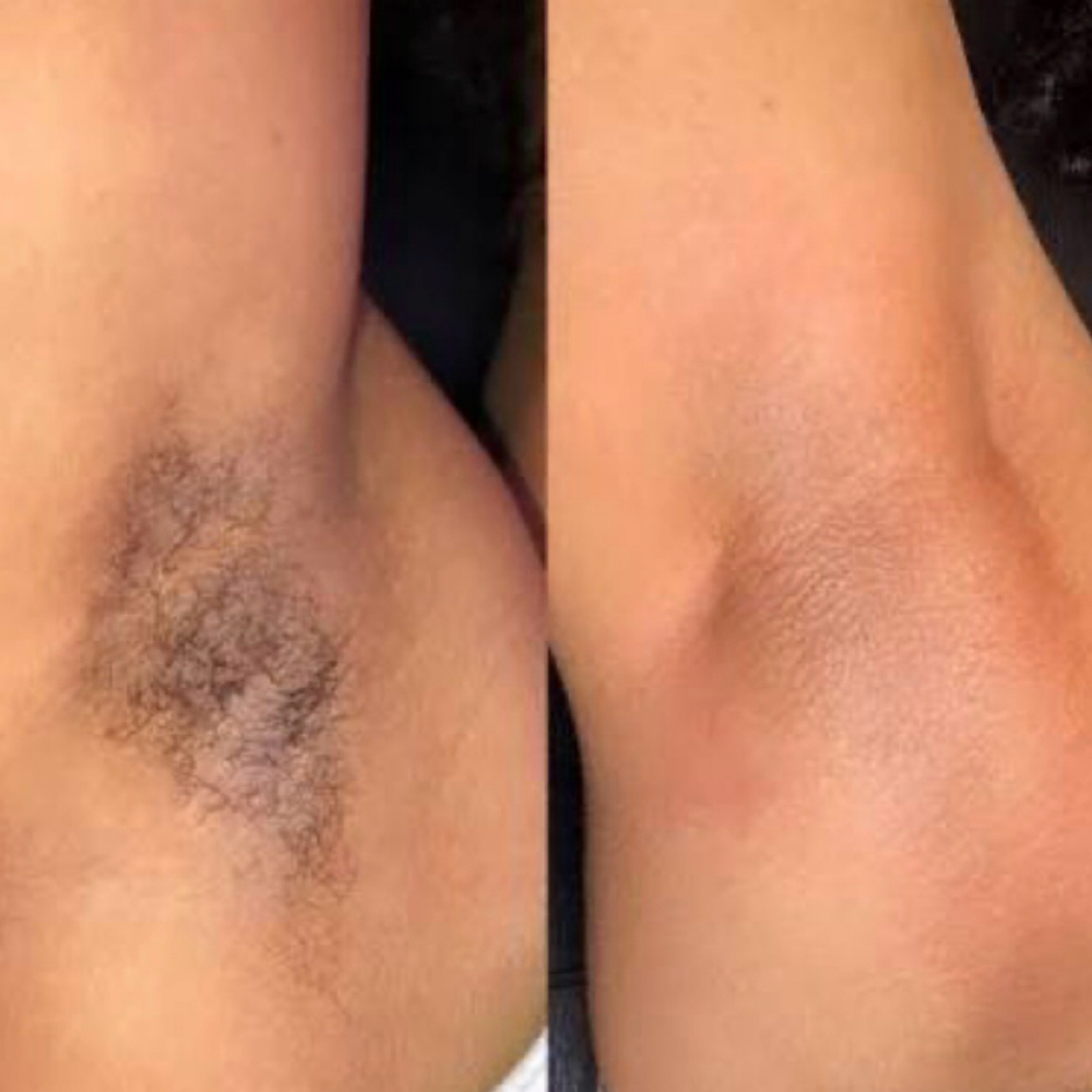 Underarm Wax at Four Roots Beauty Collective in rock island, IL