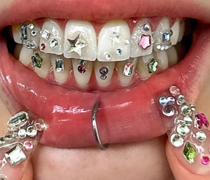 Tooth Gem Freestyle - 12 Teeth