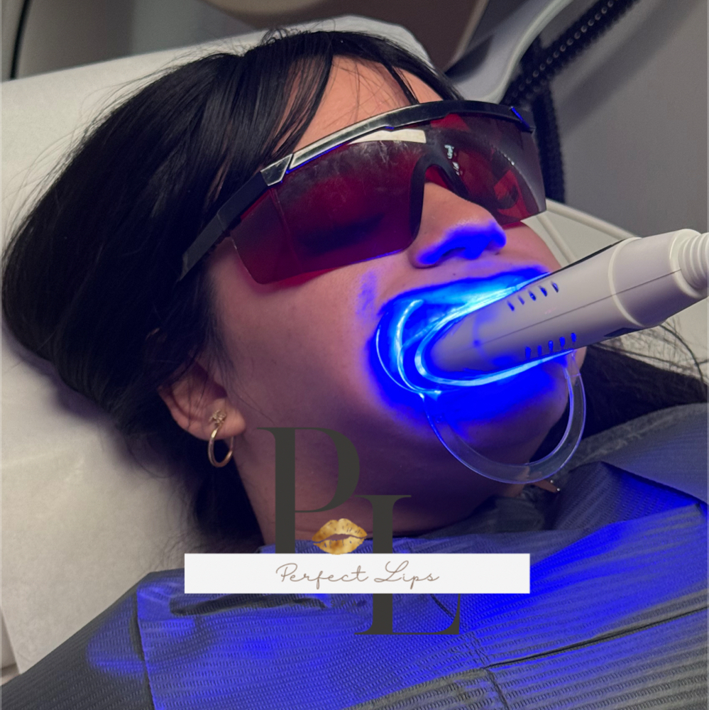 Whitening Teeth