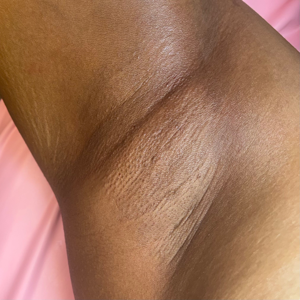 Underarm Wax