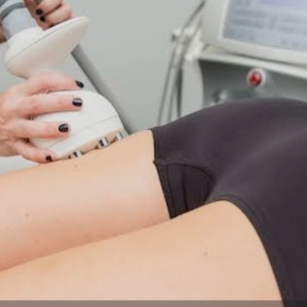 Endermotherapy w Laser Lipo (5 Sessions) at Le Bar Beaute in Indian Trail, NC