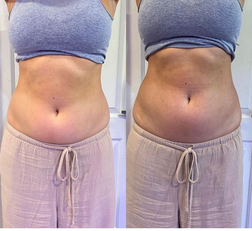 detox treatment