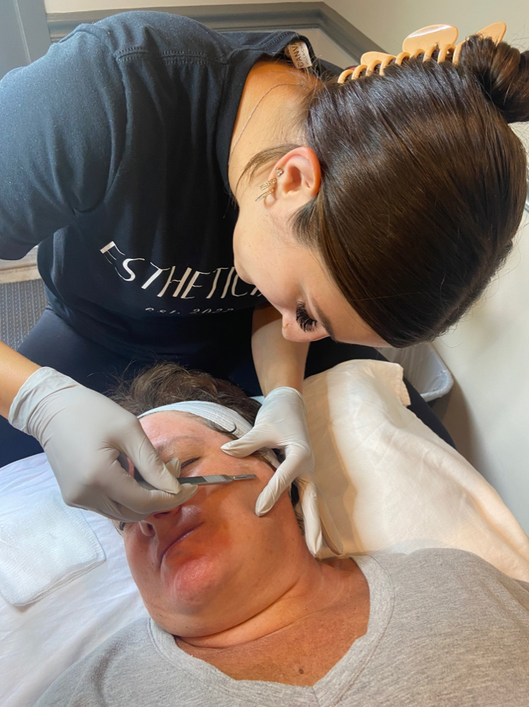 Dermaplaning And Peel Treatment