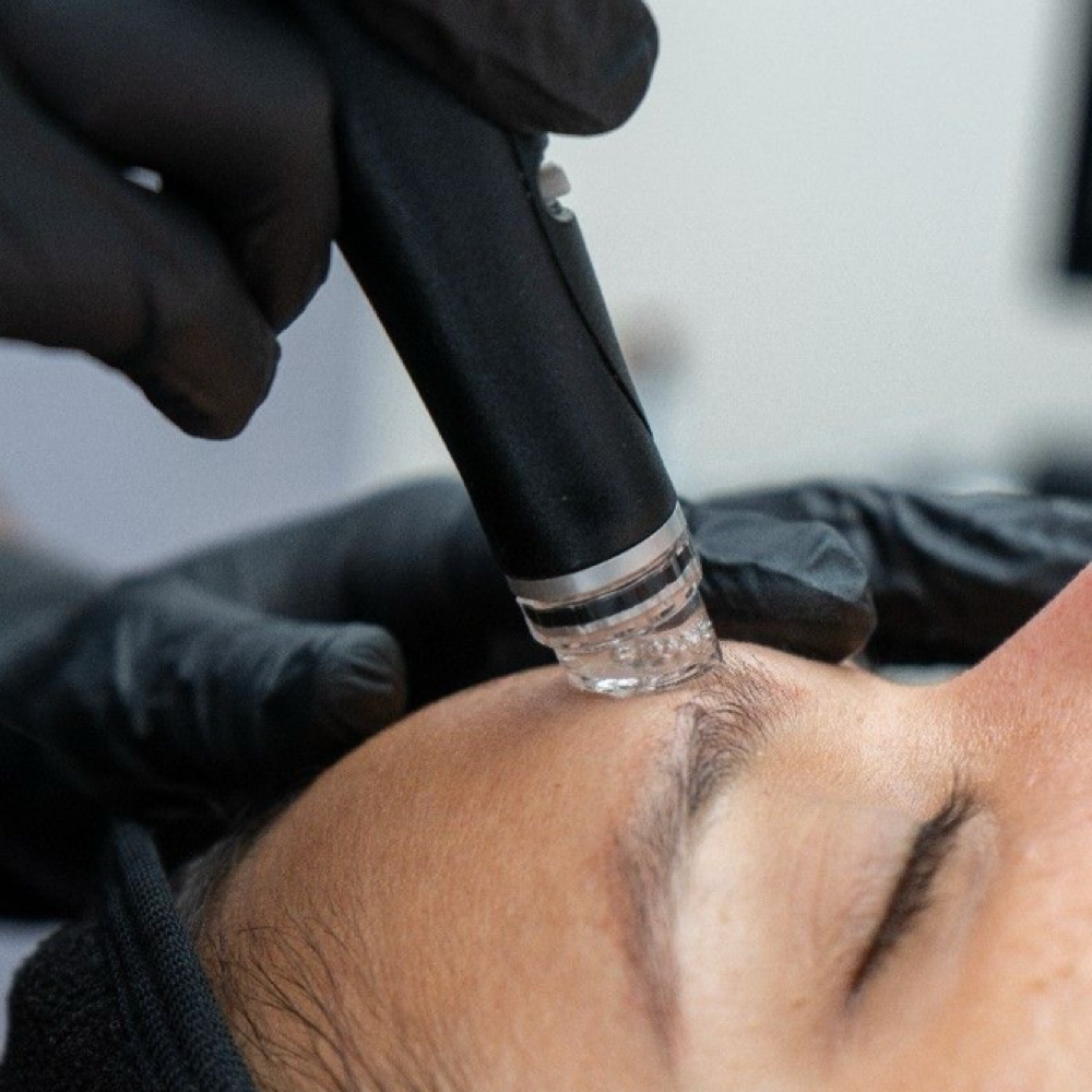 Deluxe Hydrofacial at B.E. Aesthetics in Port Saint Lucie, FL