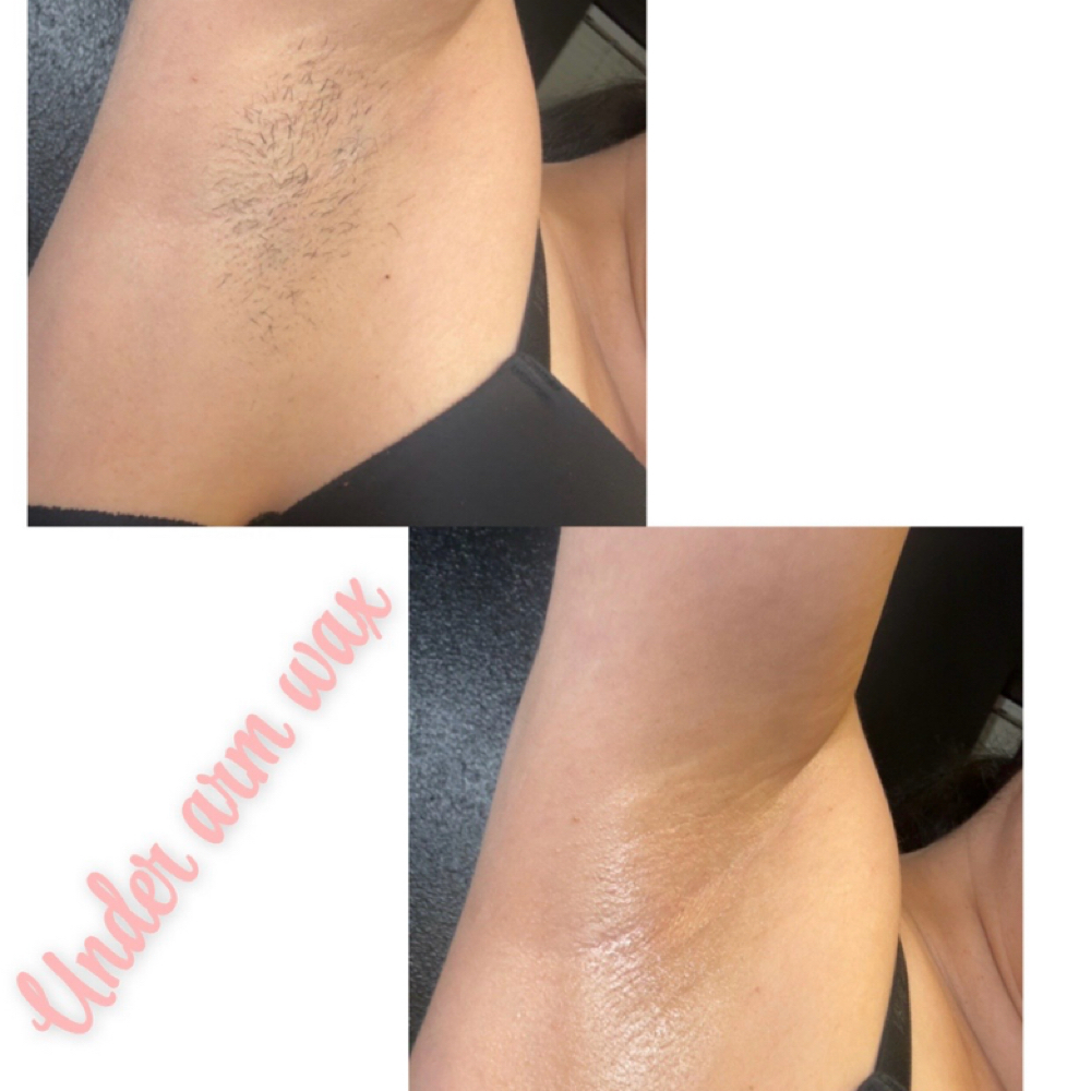 Under Arm Waxing at Beauty Esthetics Loft in Denver, CO