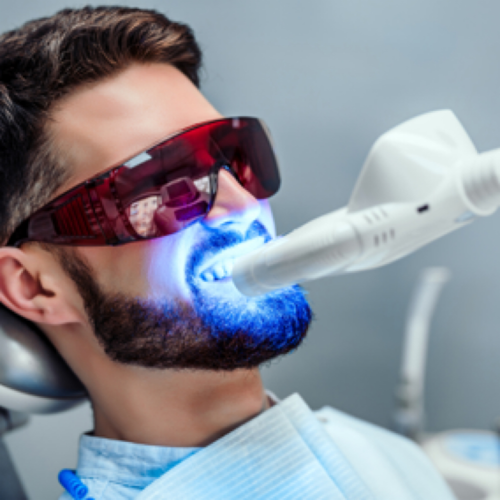 Laser Teeth Whitening