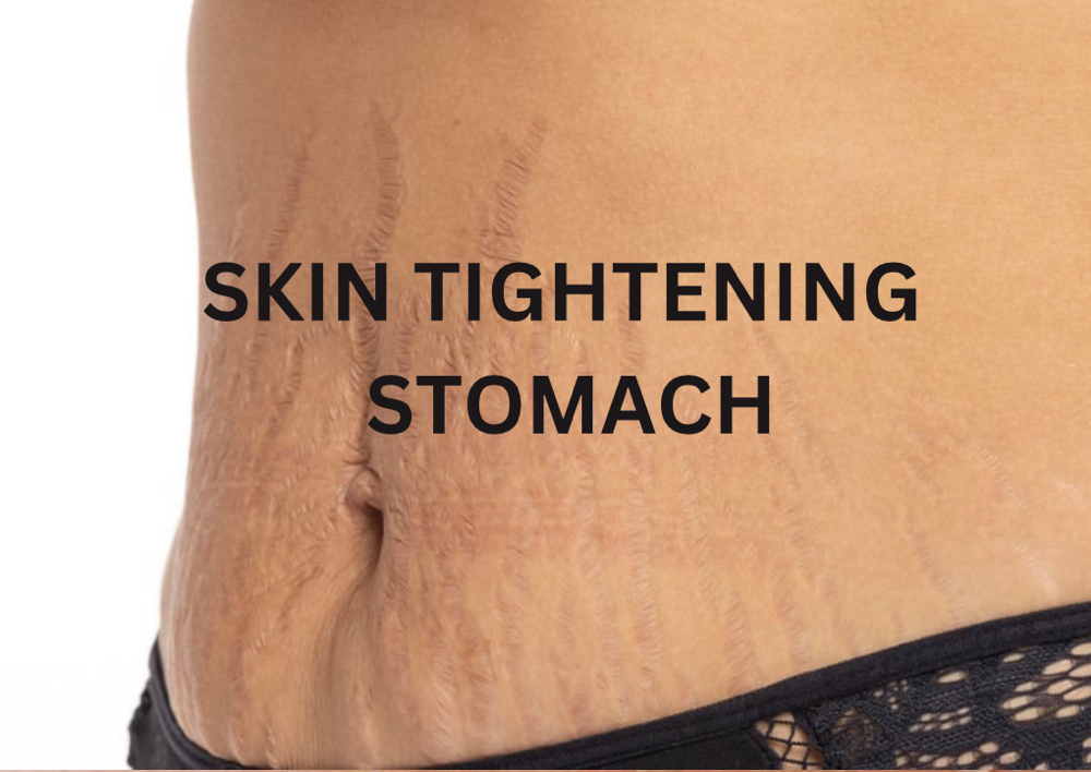 Skin Tightening • Stomach