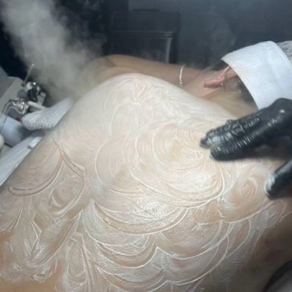 Back Facial at Radiance Beauty in Kingsport, TN