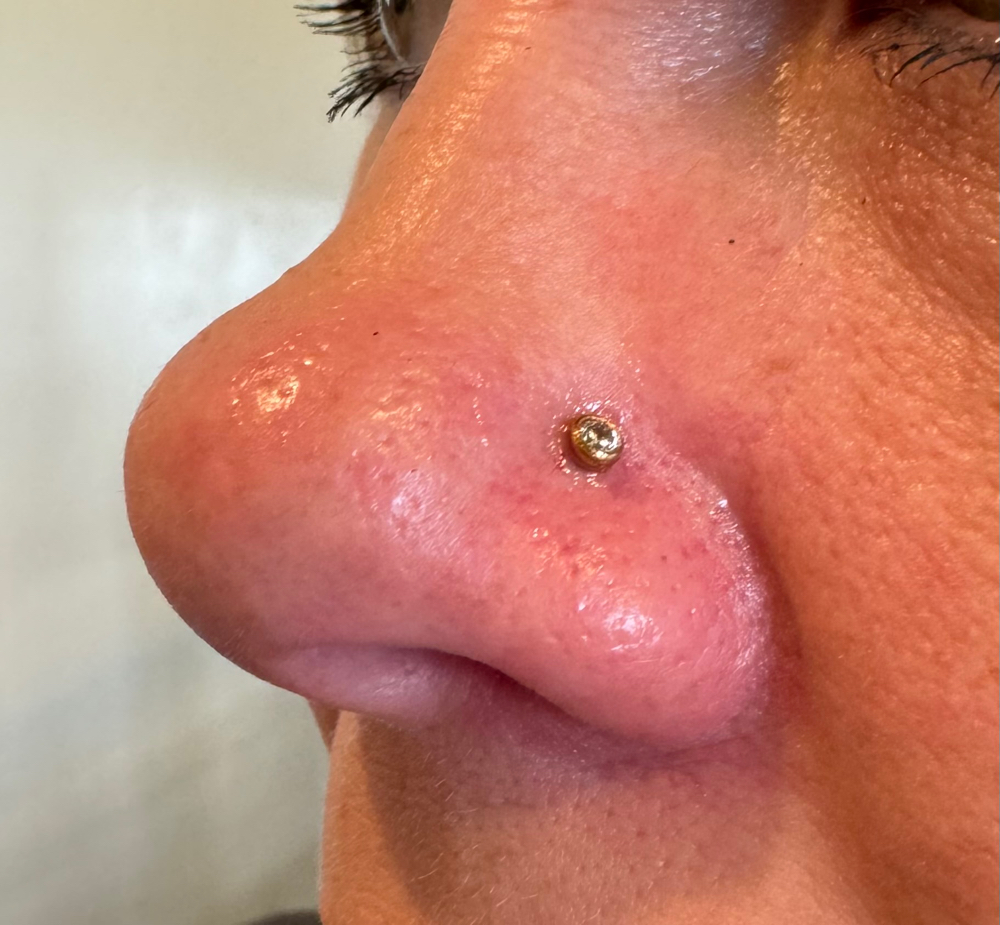Nostril