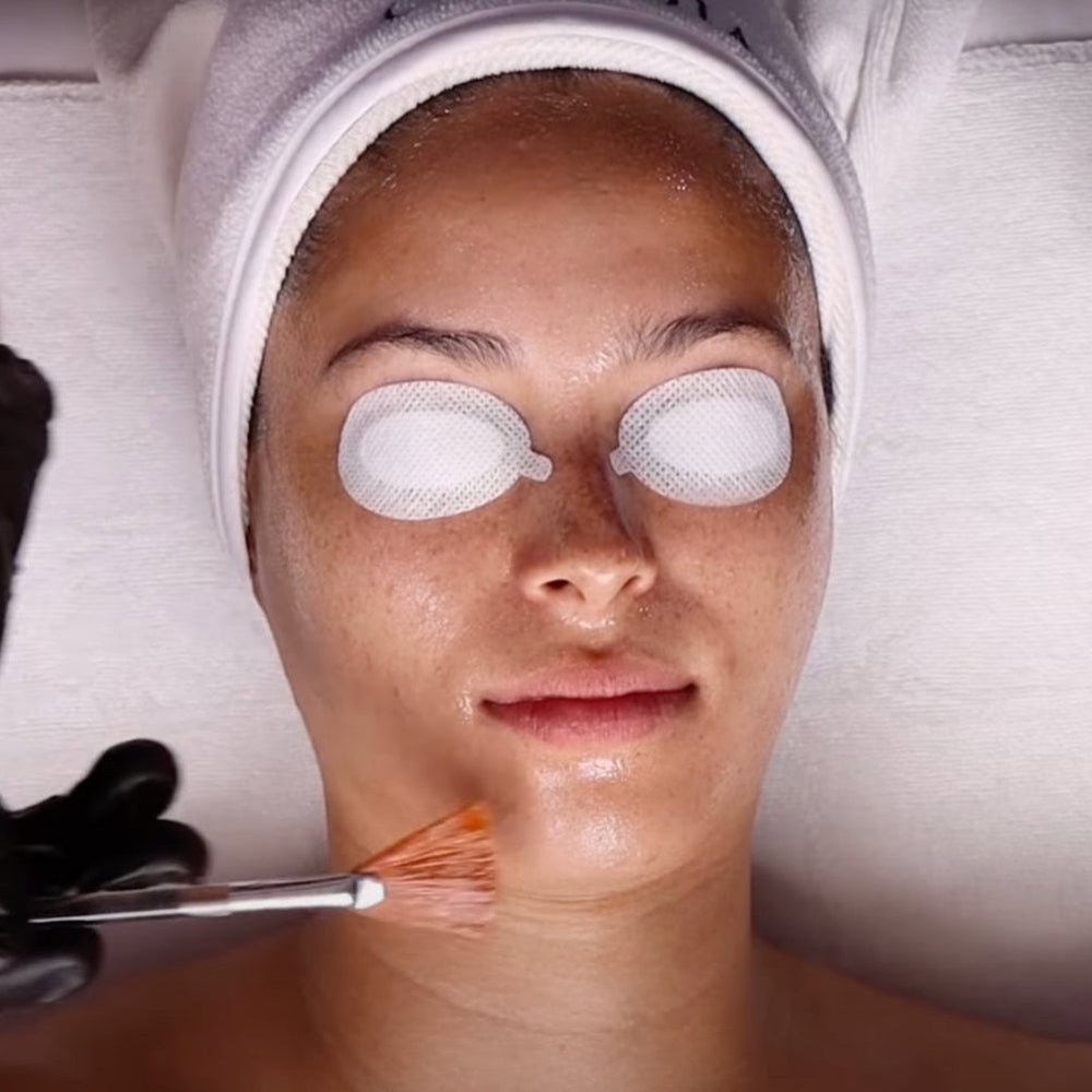 Alpha-Beta Acid Peel at the Treatment Lounge: Studio 11C in Lake Forest, CA
