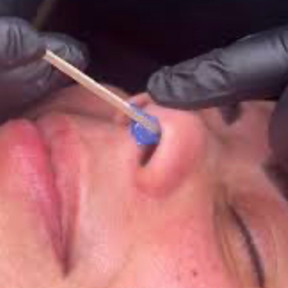 Nose Wax at SKIN by Christine Russell in Green Bay, WI