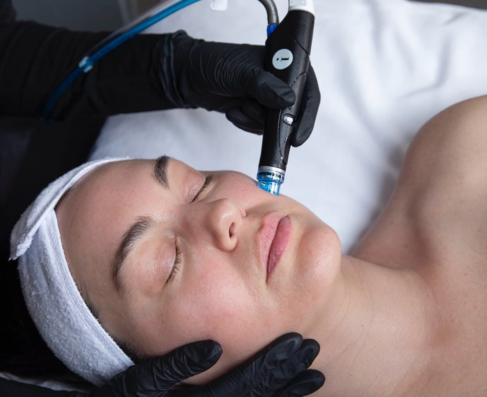 Platinum Hydrafacial at Lace Esthetics in Chino Valley, AZ