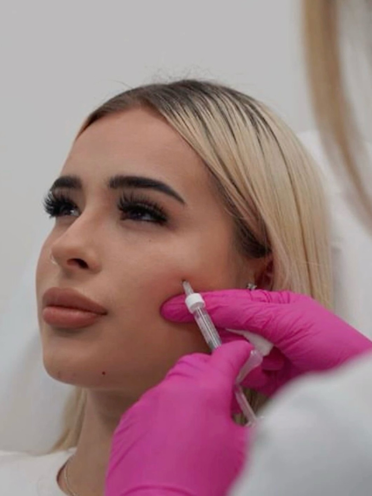 Cheek Contour Filler 1ml