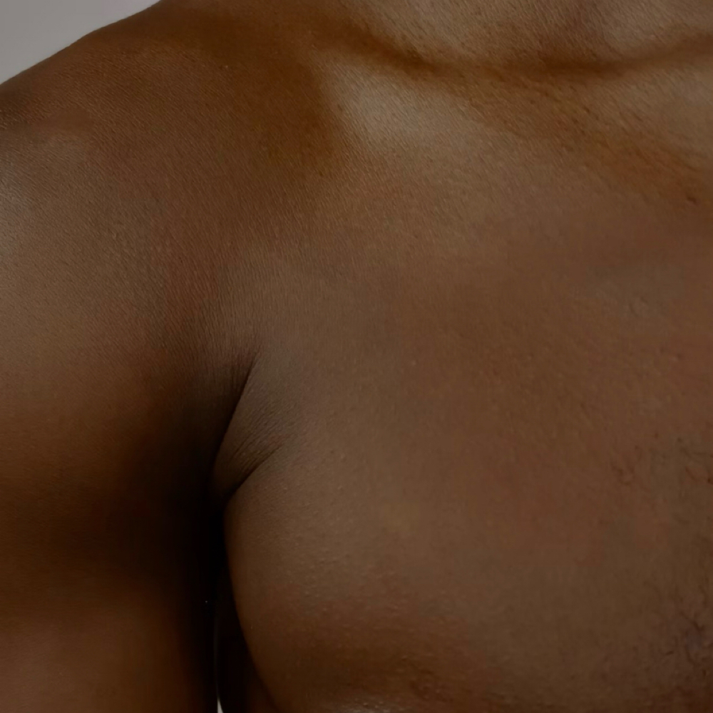 Full Chest / 6 Sessions at EverBeauty Laser & Aesthetics in Argyle, TX