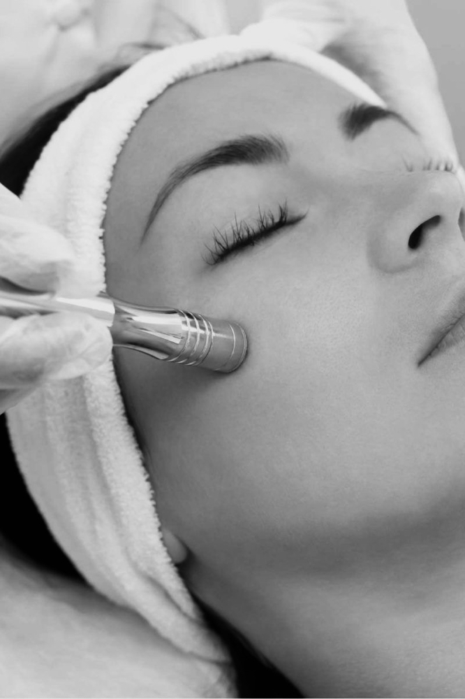 Microdermabrasion Facial