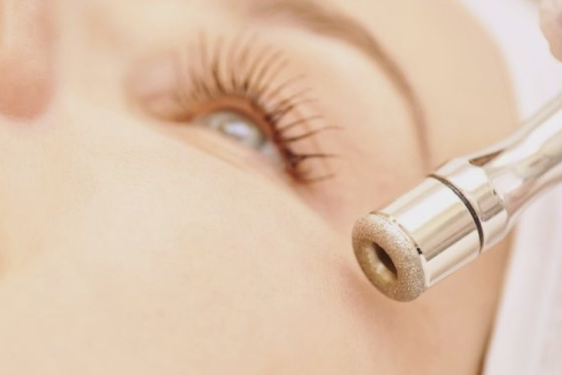 Microdermabrasion at Yirah Beauty in Houston, TX