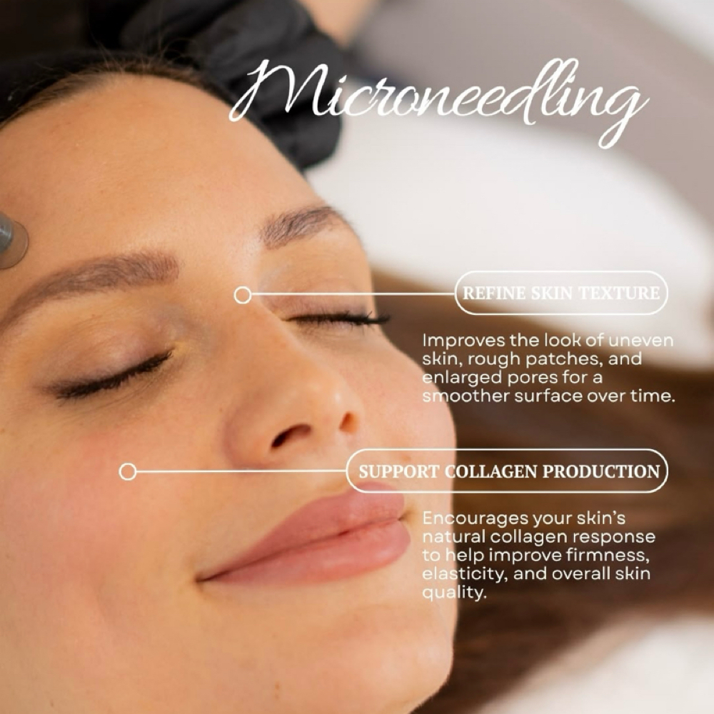 Micro Needling at Skin Deep Beauty Spa in Sulphur, LA