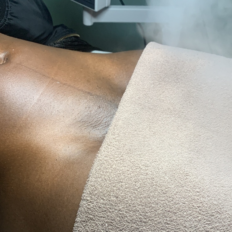 Brazilian + Maintenance Vagacial at Velnaira in Lakewood, CA