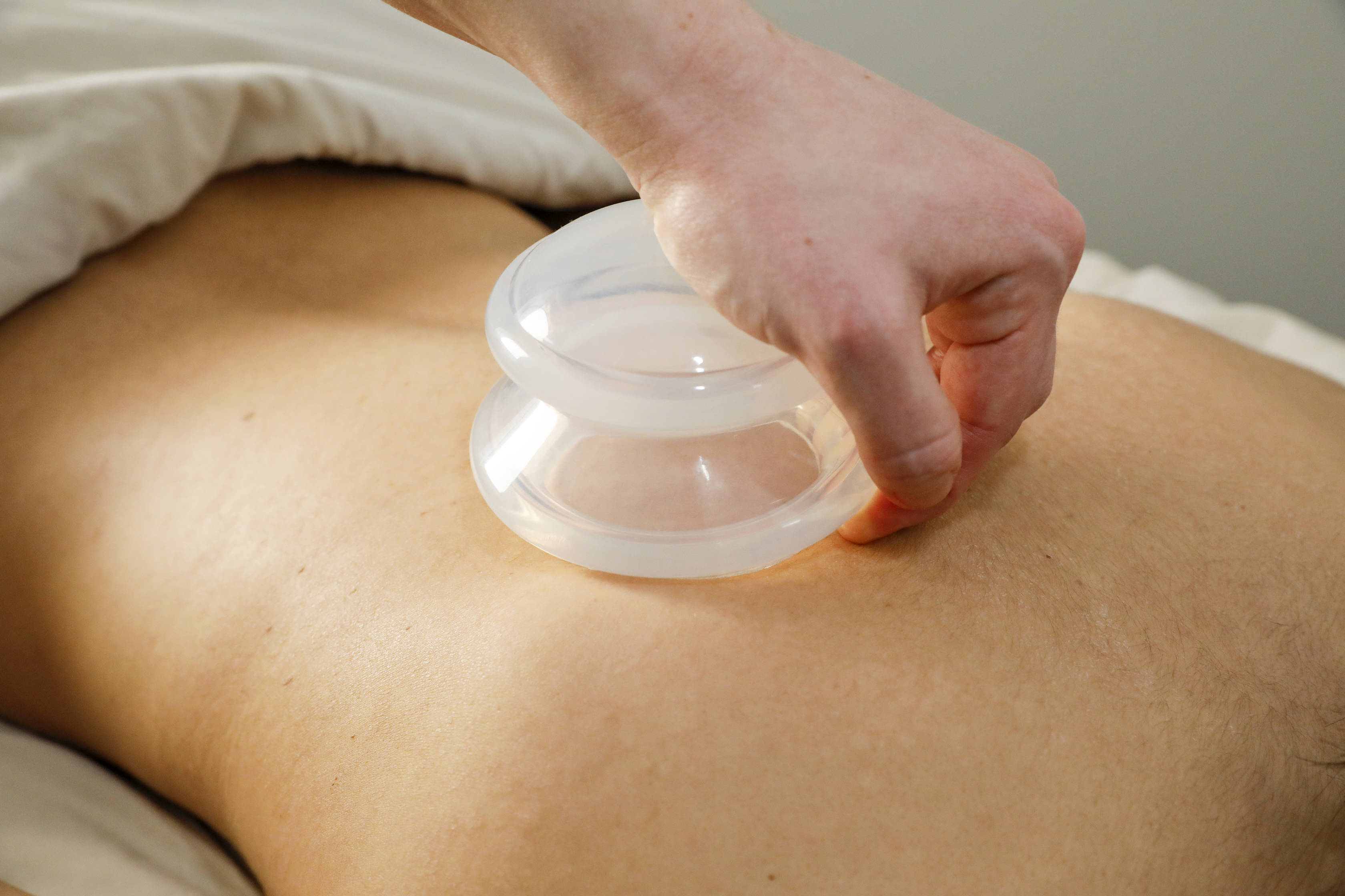 Cupping add-on