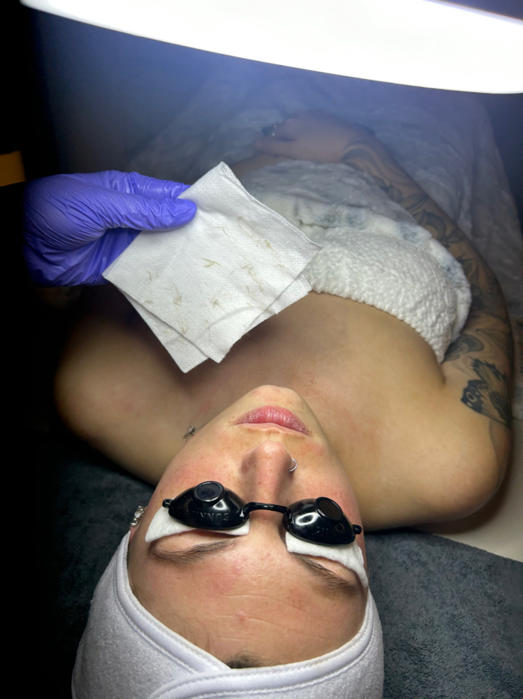 Dermaplane Facial