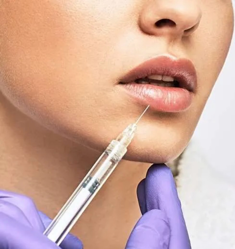 Lip Filler Dissolving at Lumos Luxe Aesthetics in Canyon Lake, CA
