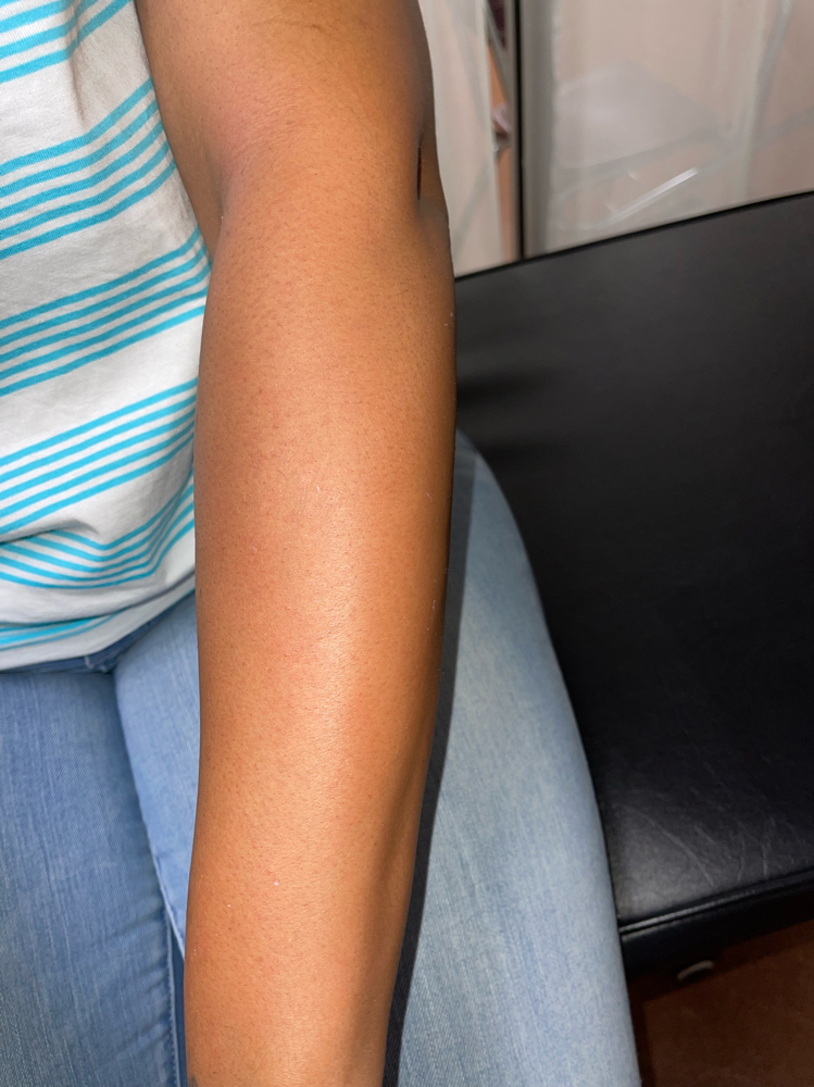 Arm (half)