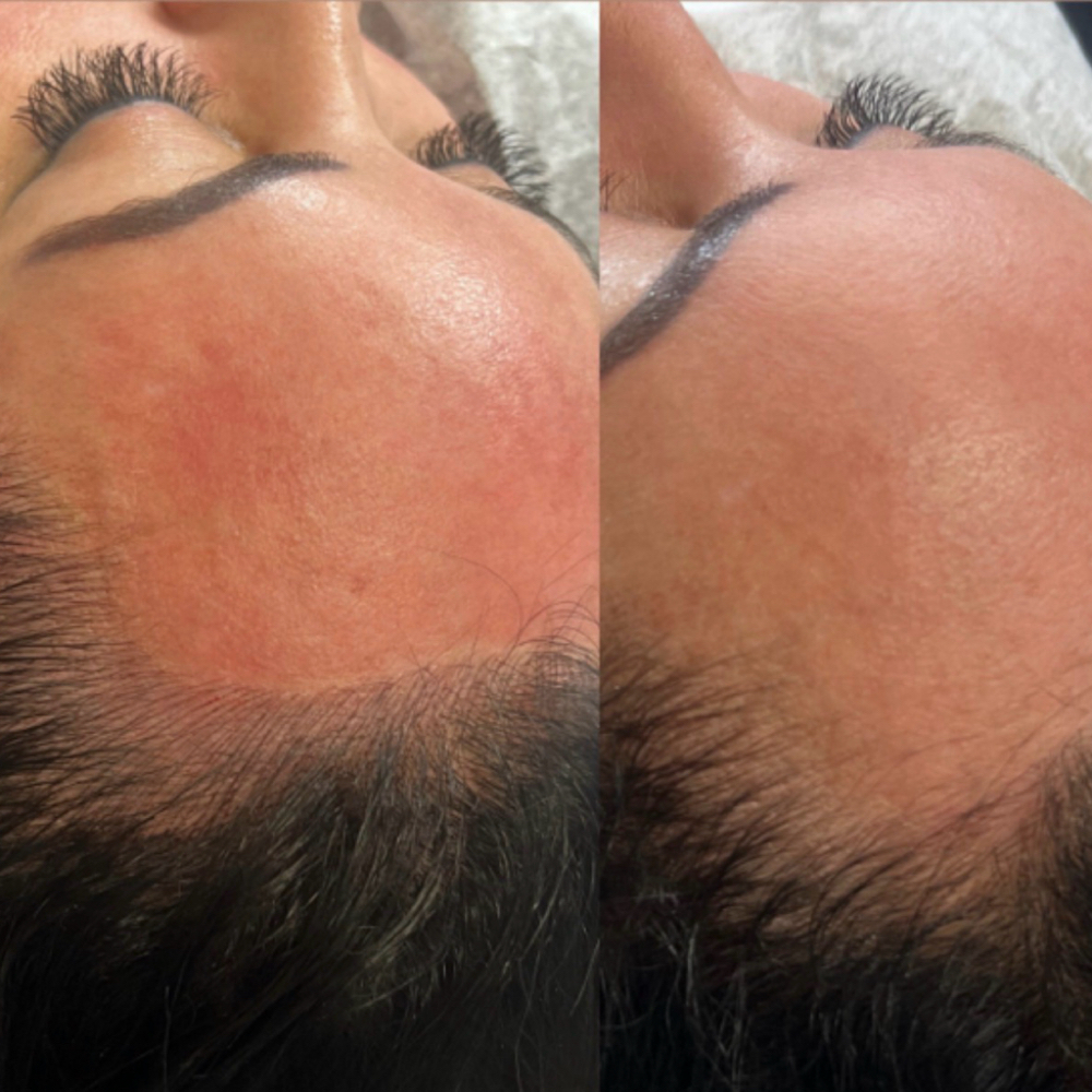 Hairline Scalp Pigmentation at Organic Beauty By Eve in Garden City, NY