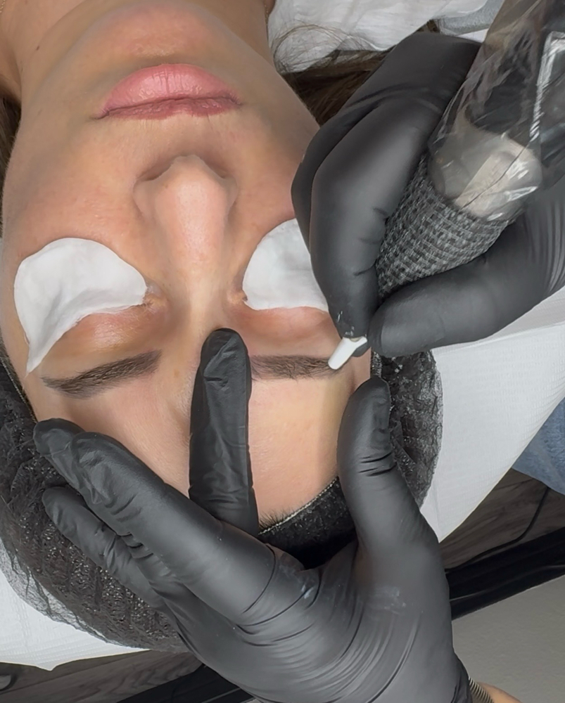 Magnetic Tattoo Removal