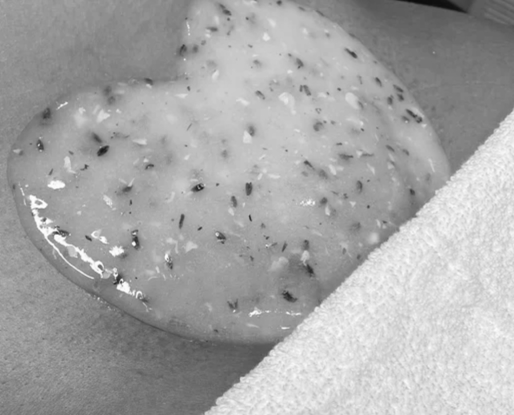 Microdermabrasion vajacial Add On