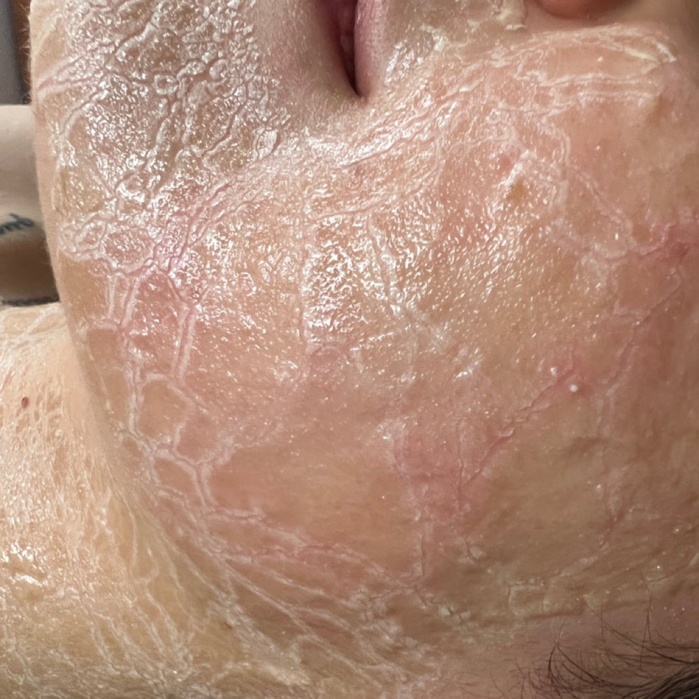 Firming Peptide Mask Add On at Fresh Bloom Esthetics in Princeton, IN