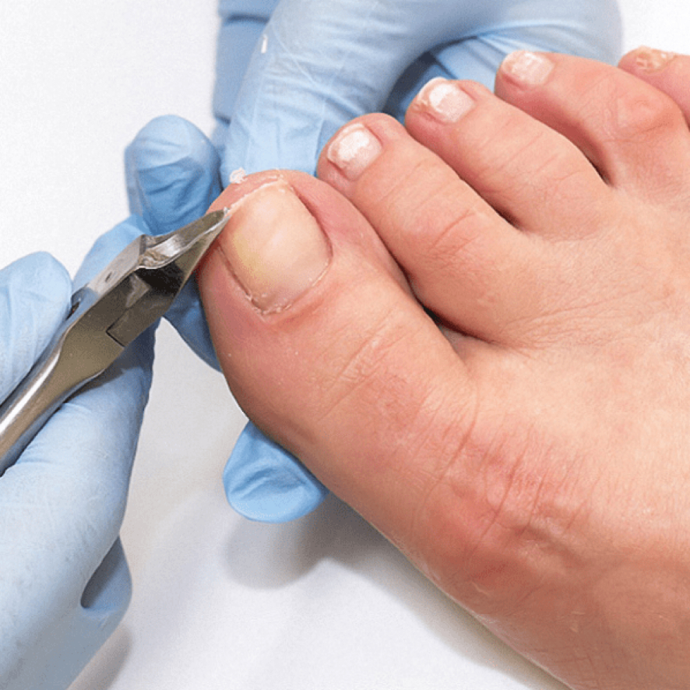 Pedicure Preventivo Foot Care at Rut Albornoz/Foot Care37 in Rhode Island, RI