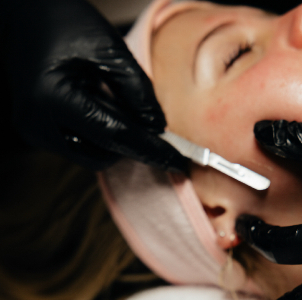 Dermaplane at Radiant Glow Esthetics in Baker City, OR