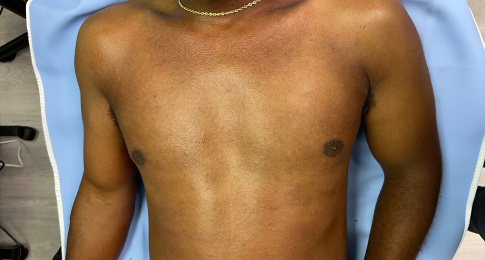 Chest Wax