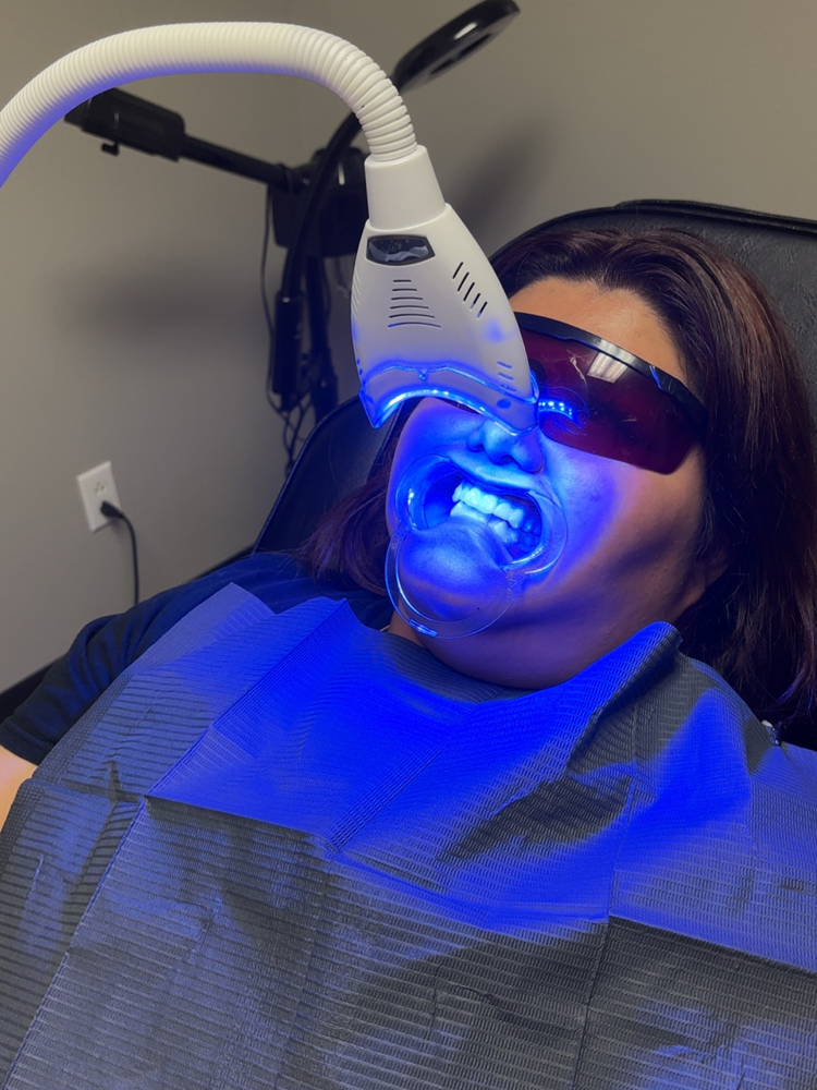 Teeth Whitening at Enhancing Beauty in Jacksonville, TX