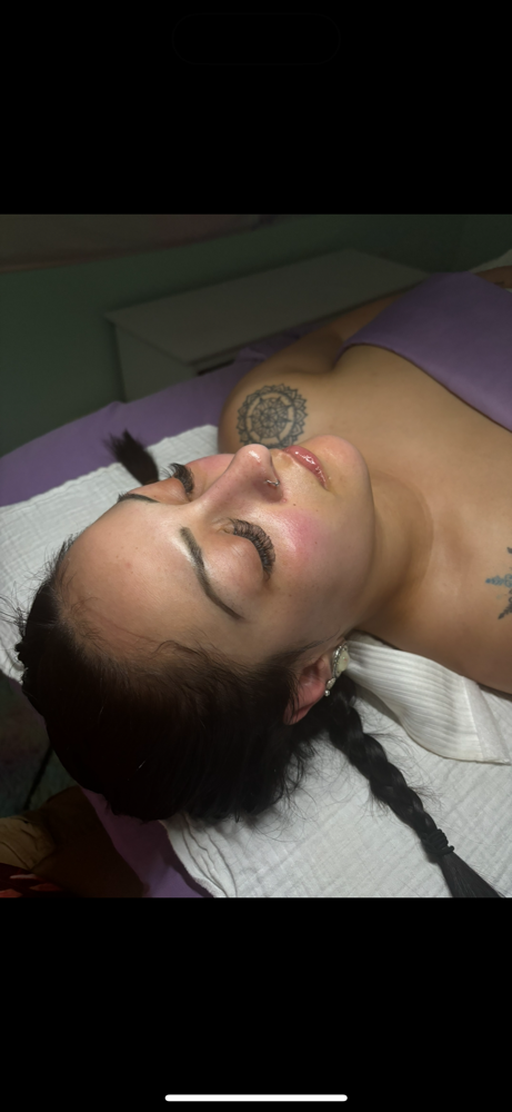 Customized Chemical Peel ✨