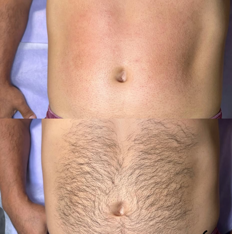 Stomach WAX