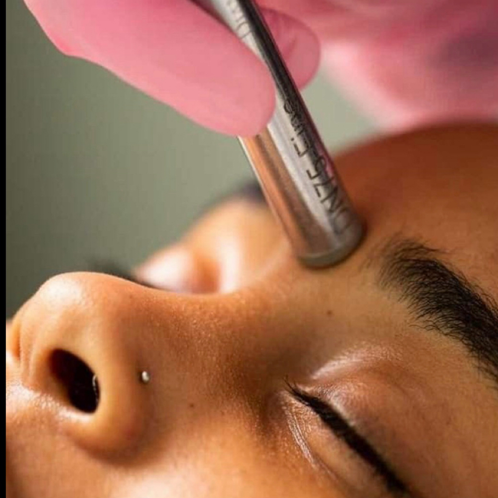 Microdermabrasion Deluxe