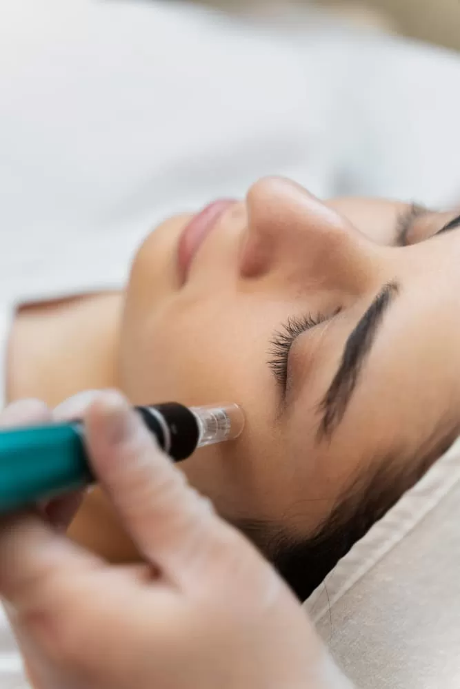 Microneedling Face, Neck, Decollete