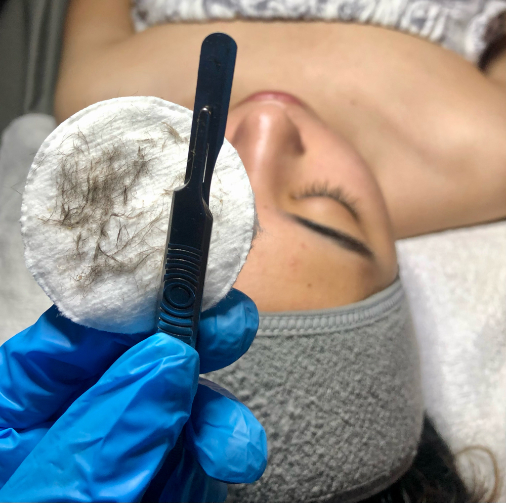 Dermaplane Facial